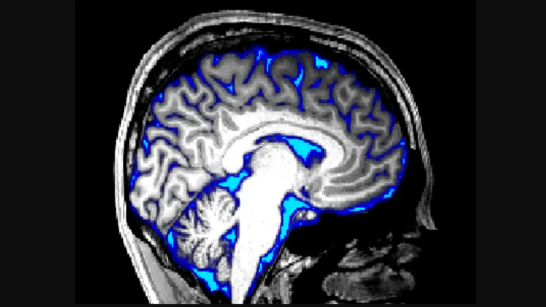 दिमागी थकान दूर करने के लिए हमारा ब्रेन कर सकता है फ्लश आउट! स्टडी में चौंकाने वाला खुलासा